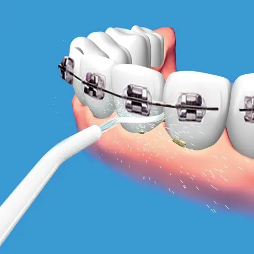 Водний ополіскувач для зубів Power Floss іригатор для ротової порожнини. - фото 7