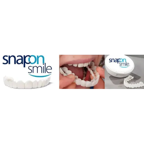 Накладні вініри для зубів Snap on smile з кейсом знімні - фото 3