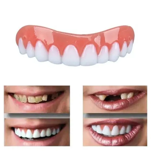 Вініри для зубів Perfect smile veneers. Голлівудська усмішка - фото 6