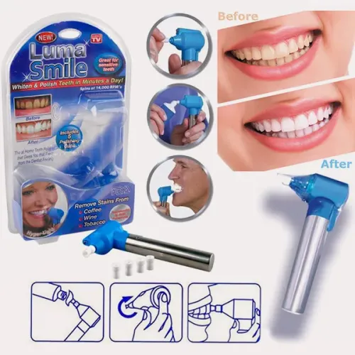 Набір для відбілювання зубів Luma Smile - фото 2