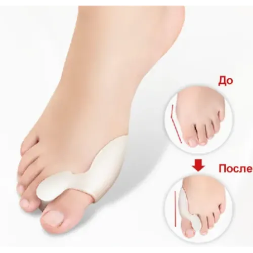 Силиконовый корректор большого пальца Valgus Pro, вальгусный бандаж - фото 3