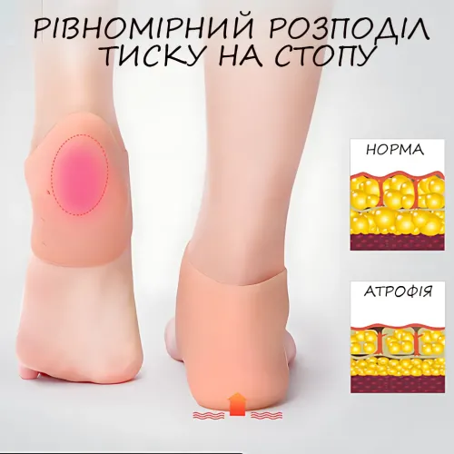 Силиконовая защита пятки AND267, силиконовый фиксатор для пяток от мозолей и трещин, бандаж на пятку - фото 8